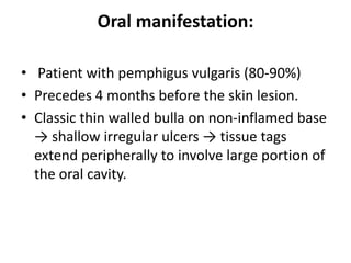 Oral manifestation:
• Patient with pemphigus vulgaris (80-90%)
• Precedes 4 months before the skin lesion.
• Classic thin walled bulla on non-inflamed base
→ shallow irregular ulcers → tissue tags
extend peripherally to involve large portion of
the oral cavity.
 