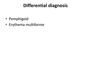 Differential diagnosis
• Pemphigoid
• Erythema multiforme
 