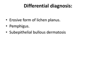 Differential diagnosis:
• Erosive form of lichen planus.
• Pemphigus.
• Subepithelial bullous dermatosis
 