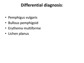 Differential diagnosis:
• Pemphigus vulgaris
• Bullous pemphigoid
• Erythema multiforme
• Lichen planus
 