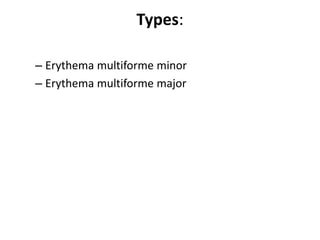 Types:
– Erythema multiforme minor
– Erythema multiforme major
 