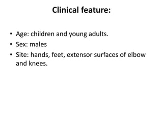 Clinical feature:
• Age: children and young adults.
• Sex: males
• Site: hands, feet, extensor surfaces of elbow
and knees.
 