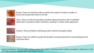Comprehensive Clinical Insights into Vesiculobullous Lesions: Diagnosis ...