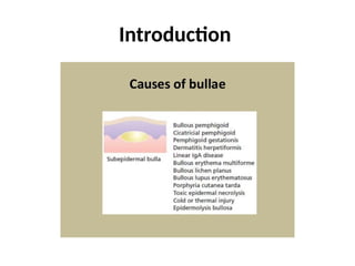 bullous dermatosis in dermatology part 2.pptx