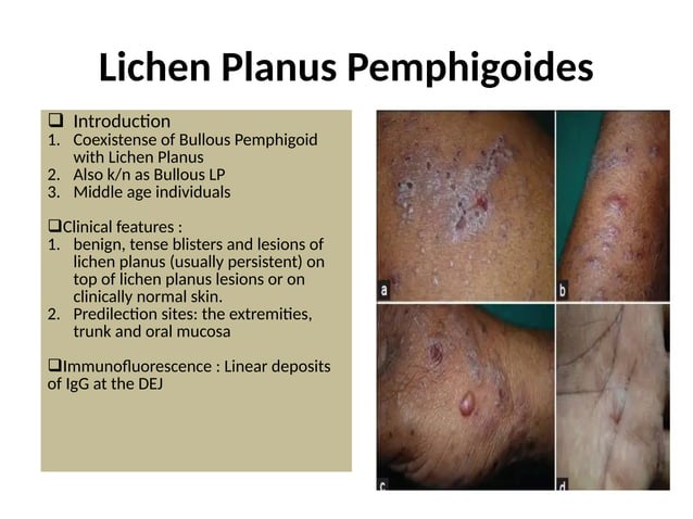 bullous dermatosis in dermatology part 2.pptx