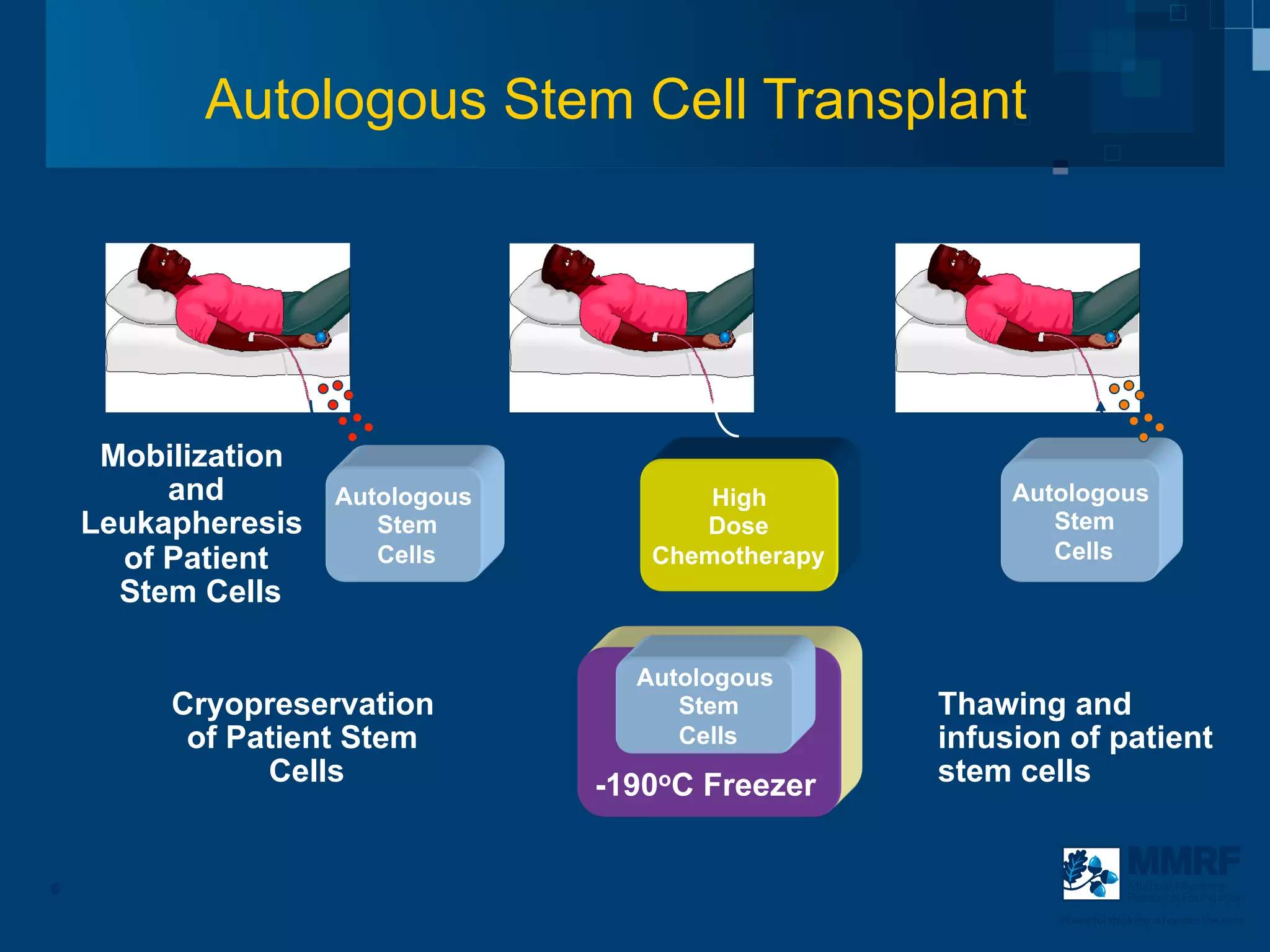 Autologous Stem Cell Transplant




     Mobilization
         and        Autologous          High            Autologous
    Leukapheresis      Stem            Dose                Stem
      of Patient       Cells        Chemotherapy           Cells
      Stem Cells

                                   Autologous
         Cryopreservation             Stem         Thawing and
          of Patient Stem             Cells        infusion of patient
               Cells             -190oC Freezer    stem cells


6                                                                      Multiple Myeloma
                                                                       Research Foundation

                                                           Powerful thinking advances the cure
 