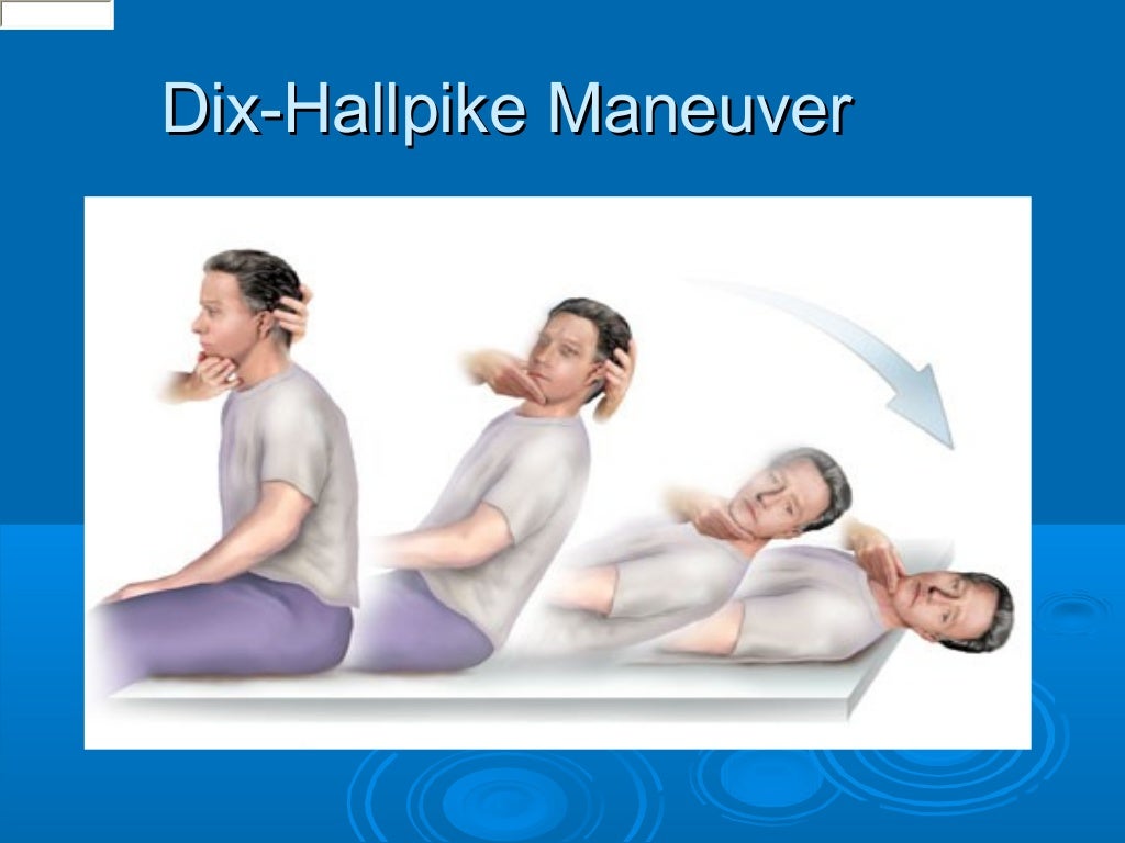 vertigo and the Vestibular system