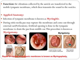 Function:Air vibrations collected by the auricle are transferred to the
mobile tympanic membrane, which then transmits the sound to the ossicles.
 Applied Anatomy:
 Infection of tympanic membrane is known as Myringitis.
 During otitis media pus may rupture the membrane and come out through
external ear(Perforation).Artificial opening is done in the tympanic
membrane to drain the pus from middle ear.This procedure is known as
Myrigotomy.
Repair of rupture of tympanic membrane is known as Myringoplasty.
Myrigotomy.
 