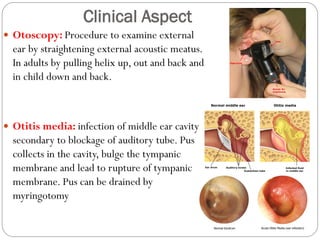 Clinical Aspect
 Otoscopy: Procedure to examine external
ear by straightening external acoustic meatus.
In adults by pulling helix up, out and back and
in child down and back.
 Otitis media: infection of middle ear cavity
secondary to blockage of auditory tube. Pus
collects in the cavity, bulge the tympanic
membrane and lead to rupture of tympanic
membrane. Pus can be drained by
myringotomy
 