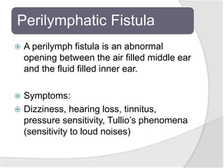 Perilymphatic Fistula
 A perilymph fistula is an abnormal
opening between the air filled middle ear
and the fluid filled inner ear.
 Symptoms:
 Dizziness, hearing loss, tinnitus,
pressure sensitivity, Tullio’s phenomena
(sensitivity to loud noises)
 