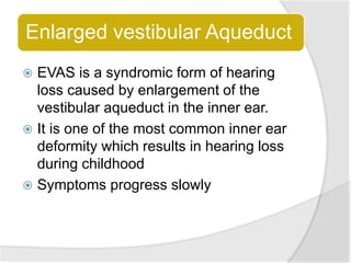 Enlarged vestibular Aqueduct
 EVAS is a syndromic form of hearing
loss caused by enlargement of the
vestibular aqueduct in the inner ear.
 It is one of the most common inner ear
deformity which results in hearing loss
during childhood
 Symptoms progress slowly
 