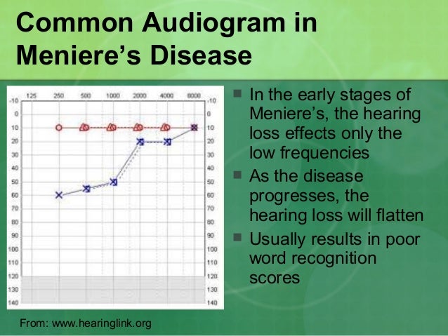 Vestibular disorders