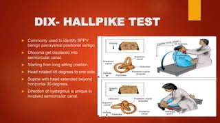 DIX- HALLPIKE TEST
 Commonly used to identify BPPV
benign paroxysmal positional vertigo.
 Otoconia get displaced into
semicircular canal.
 Starting from long sitting position.
 Head rotated 45 degrees to one side.
 Supine with head extended beyond
horizontal 30 degrees.
 Direction of nystagmus is unique to
involved semicircular canal.
 