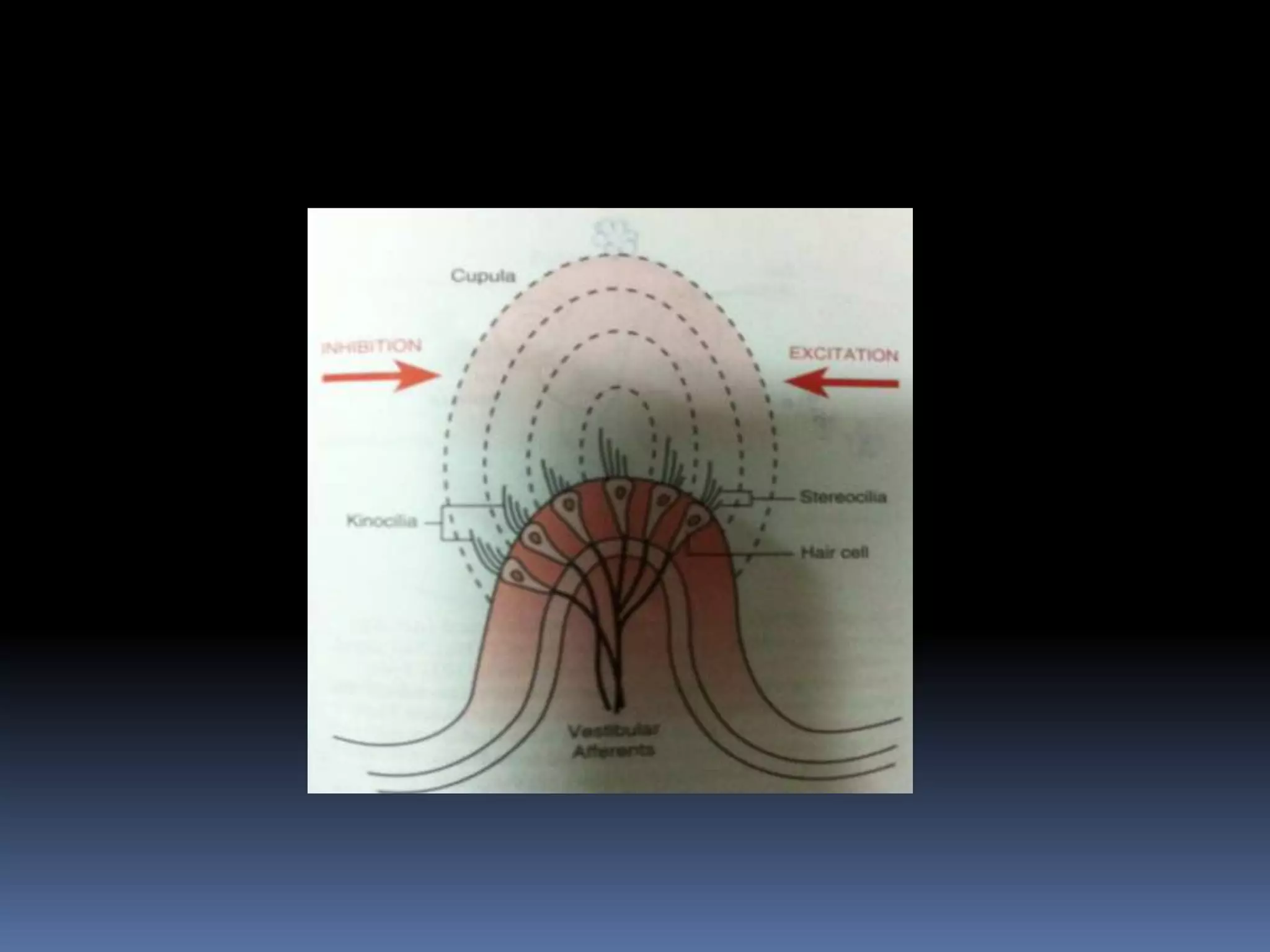 Vestibular function test and its clinical examination | PPTX