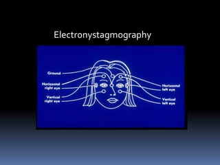 Electronystagmography
 