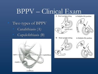 vestibular_handouts.ppt vestibular_handouts | PPT