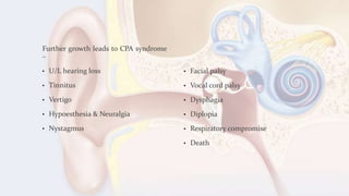 Further growth leads to CPA syndrome
–
• U/L hearing loss
• Tinnitus
• Vertigo
• Hypoesthesia & Neuralgia
• Nystagmus
• Facial palsy
• Vocal cord palsy
• Dysphagia
• Diplopia
• Respiratory compromise
• Death
 