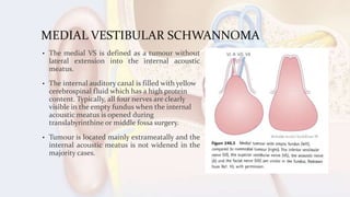 MEDIAL VESTIBULAR SCHWANNOMA
• The medial VS is defined as a tumour without
lateral extension into the internal acoustic
meatus.
• The internal auditory canal is filled with yellow
cerebrospinal fluid which has a high protein
content. Typically, all four nerves are clearly
visible in the empty fundus when the internal
acoustic meatus is opened during
translabyrinthine or middle fossa surgery.
• Tumour is located mainly extrameatally and the
internal acoustic meatus is not widened in the
majority cases.
 