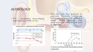 AUDIOLOGY
• PTA – asymmetric, down-sloping,
high-frequency, SNHL in 70%.
• SDSs are lower than predicted by
pure-tone thresholds, which are
further accentuated when retested at
higher speech intensity. This
phenomenon is called roll over. Seen
in nearly 50%.
 