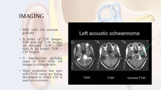 IMAGING
• MRI with Gd contrast –
gold std
• A series of T1W images,
T1W with Gd, T2W images
are obtained. (T1W – CSF
dark & fat bright, T2W –
CSF bright).
• A hypointense globular
mass in T1W with Gd
images is characteristic.
• High resolution fast spin
echo T2W scans are being
developed in which CSF is
used as a contrast.
 