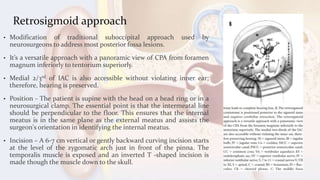 Retrosigmoid approach
• Modification of traditional suboccipital approach used by
neurosurgeons to address most posterior fossa lesions.
• It’s a versatile approach with a panoramic view of CPA from foramen
magnum inferiorly to tentorium superiorly.
• Medial 2/3rd of IAC is also accessible without violating inner ear;
therefore, hearing is preserved.
• Position - The patient is supine with the head on a head ring or in a
neurosurgical clamp. The essential point is that the intermeatal line
should be perpendicular to the floor. This ensures that the internal
meatus is in the same plane as the external meatus and assists the
surgeon's orientation in identifying the internal meatus.
• Incision – A 6-7 cm vertical or gently backward curving incision starts
at the level of the zygomatic arch just in front of the pinna. The
temporalis muscle is exposed and an inverted T -shaped incision is
made though the muscle down to the skull.
 