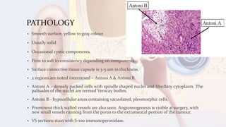 PATHOLOGY
• Smooth surface, yellow to gray colour.
• Usually solid.
• Occasional cystic components.
• Firm to soft in consistency depending on components.
• Surface connective tissue capsule is 3-5 um in thickness.
• 2 regions are noted intermixed – Antoni A & Antoni B.
• Antoni A – densely packed cells with spindle shaped nuclei and fibrillary cytoplasm. The
palisades of the nuclei are termed Verocay bodies.
• Antoni B - hypocellular areas containing vacuolated, pleomorphic cells.
• Prominent thick walled vessels are also seen. Angioneogenesis is visible at surgery, with
new small vessels running from the porus to the extrameatal portion of the tumour.
• VS sections stain with S-100 immunoperoxidase.
 