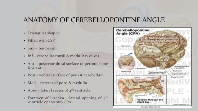 CEREBELLOPONTINE ANGLE SYNDROME DOWNLOAD CEREBELLOPONTINE ANGLE SYNDROME DOWNLOAD