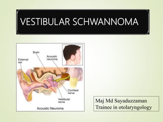 VESTIBULAR SCHWANNOMA
Maj Md Sayaduzzaman
Trainee in otolaryngology
 
