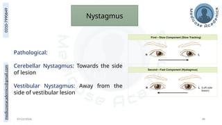 medicoseacademics@gmail.com
0310-7990649
07/22/2026 49
Nystagmus
Pathological:
Cerebellar Nystagmus: Towards the side
of lesion
Vestibular Nystagmus: Away from the
side of vestibular lesion
 