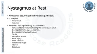 medicoseacademics@gmail.com
0310-7990649
Nystagmus at Rest
• Nystagmus occurring at rest indicates pathology.
• It may be:
• Congenital
• Acquired
• Acquired nystagmus may occur due to:
• Temporal bone fracture affecting the semicircular canals
• Damage to the flocculonodular lobe
• Damage to the fastigial nucleus
• Stroke
• Multiple sclerosis
• Head injury
• Brain tumours
• Antiseizure drugs
• Alcohol
• Sedatives
 