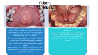 parecen en la línea media del paladar duro, con formas
diversas (planos, fusiformes, nodulares o polilobulados).
La mucosa que los cubre suele estar íntegra, a veces algo
más pálida, aunque si se traumatiza se ulcera con cierta
facilidad y puede tardar en cicatrizar.
Son frecuentes, aparecen hasta en un 20% de la población.
El tamaño puede variar desde tan pequeños que pasan
inadvertidos y se detectan por palpación, hasta otros que
llegan a ocupar todo el paladar interfiriendo con el habla
normal.
Habitualmente se localizan en la porción central de la línea
media del paladar, aunque también pueden aparecer en la
parte anterior o posterior
Son más raros que los palatinos (cerca del 8% de la
población).
Aparecen en la superficie lingual de la mandíbula, sobre
todo en la zona de los premolares, aunque pueden
extenderse hacia los molares o hacia los incisivos.
Pueden tener varias formas, con protuberancias únicas o
múltiples.
Palatina
Mandibular
 