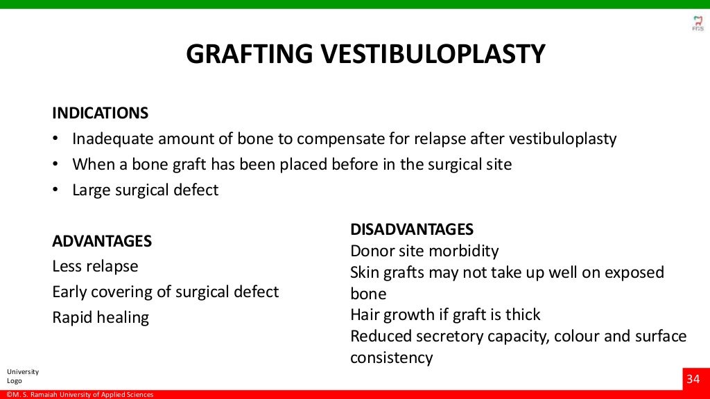 Vestibuloplasty ridge extension procedures