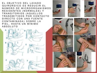 E L O B J E T I V O D E L L AVA D O
QUIRÚRGICO ES REDUCIR EL
NÚMERO DE MICROORGANISMOS
RESIDENTES (NORMALES) Y
TRANSITORIOS (AQUELLOS
T R A N S M I T I D O S P O R C O N TA C T O
DIRECTO CON UNA FUENTE
C O N TA M I N A D A ) S O B R E L A
P I E L , H A S TA U N M Í N I M O
ABSOLUTO

 