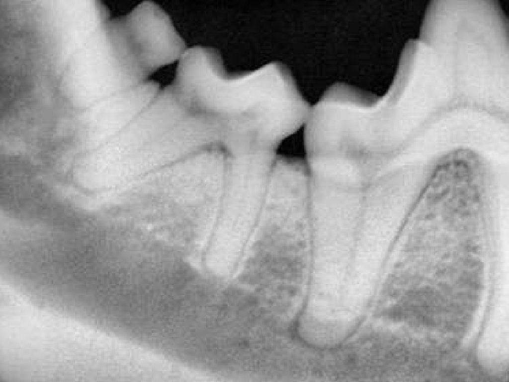 Veterinary Dental Radiography Simplified