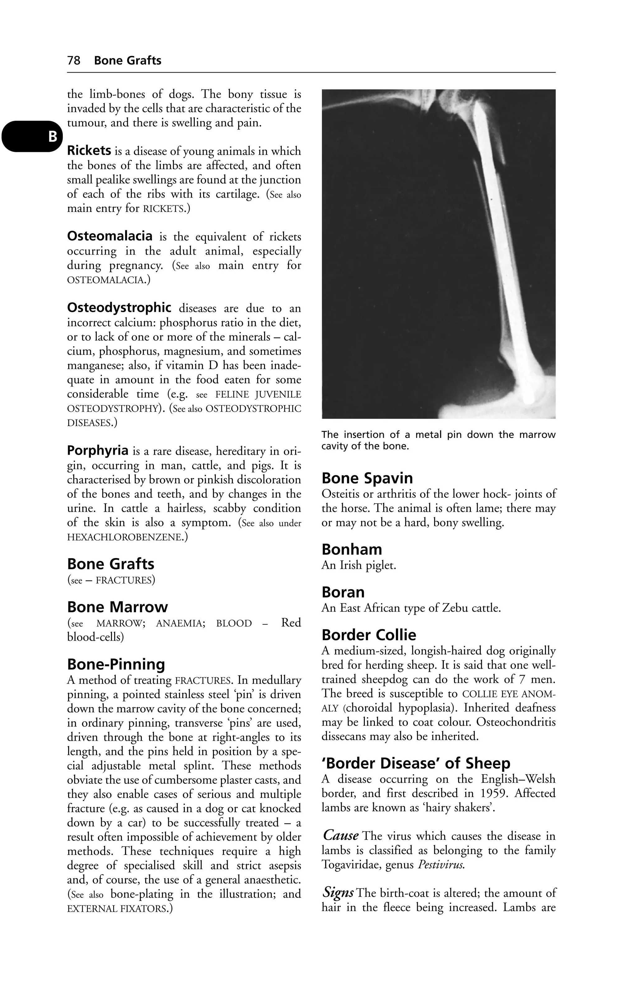 the limb-bones of dogs. The bony tissue is 
invaded by the cells that are characteristic of the 
tumour, and there is swelling and pain. 
Rickets is a disease of young animals in which 
the bones of the limbs are affected, and often 
small pealike swellings are found at the junction 
of each of the ribs with its cartilage. (See also 
main entry for RICKETS.) 
Osteomalacia is the equivalent of rickets 
occurring in the adult animal, especially 
during pregnancy. (See also main entry for 
OSTEOMALACIA.) 
Osteodystrophic diseases are due to an 
incorrect calcium: phosphorus ratio in the diet, 
or to lack of one or more of the minerals – cal-cium, 
phosphorus, magnesium, and sometimes 
manganese; also, if vitamin D has been inade-quate 
in amount in the food eaten for some 
considerable time (e.g. see FELINE JUVENILE 
OSTEODYSTROPHY). (See also OSTEODYSTROPHIC 
DISEASES.) 
Porphyria is a rare disease, hereditary in ori-gin, 
occurring in man, cattle, and pigs. It is 
characterised by brown or pinkish discoloration 
of the bones and teeth, and by changes in the 
urine. In cattle a hairless, scabby condition 
of the skin is also a symptom. (See also under 
HEXACHLOROBENZENE.) 
Bone Grafts 
(see – FRACTURES) 
Bone Marrow 
(see MARROW; ANAEMIA; BLOOD – Red 
blood-cells) 
Bone-Pinning 
A method of treating FRACTURES. In medullary 
pinning, a pointed stainless steel ‘pin’ is driven 
down the marrow cavity of the bone concerned; 
in ordinary pinning, transverse ‘pins’ are used, 
driven through the bone at right-angles to its 
length, and the pins held in position by a spe-cial 
adjustable metal splint. These methods 
obviate the use of cumbersome plaster casts, and 
they also enable cases of serious and multiple 
fracture (e.g. as caused in a dog or cat knocked 
down by a car) to be successfully treated – a 
result often impossible of achievement by older 
methods. These techniques require a high 
degree of specialised skill and strict asepsis 
and, of course, the use of a general anaesthetic. 
(See also bone-plating in the illustration; and 
EXTERNAL FIXATORS.) 
Bone Spavin 
Osteitis or arthritis of the lower hock- joints of 
the horse. The animal is often lame; there may 
or may not be a hard, bony swelling. 
Bonham 
An Irish piglet. 
Boran 
An East African type of Zebu cattle. 
Border Collie 
A medium-sized, longish-haired dog originally 
bred for herding sheep. It is said that one well-trained 
sheepdog can do the work of 7 men. 
The breed is susceptible to COLLIE EYE ANOM-ALY 
(choroidal hypoplasia). Inherited deafness 
may be linked to coat colour. Osteochondritis 
dissecans may also be inherited. 
‘Border Disease’ of Sheep 
A disease occurring on the English–Welsh 
border, and first described in 1959. Affected 
lambs are known as ‘hairy shakers’. 
Cause The virus which causes the disease in 
lambs is classified as belonging to the family 
Togaviridae, genus Pestivirus. 
Signs The birth-coat is altered; the amount of 
hair in the fleece being increased. Lambs are 
78 Bone Grafts 
B 
The insertion of a metal pin down the marrow 
cavity of the bone. 
 