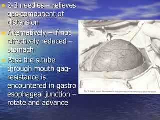 • 2-3 needles – relieves
  gas component of
  distension
• Alternatively – if not
  effectively reduced –
  stomach
• Pass the s.tube
  through mouth gag-
  resistance is
  encountered in gastro
  esophageal junction –
  rotate and advance
 