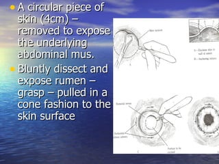 • A circular piece of
  skin (4cm) –
  removed to expose
  the underlying
  abdominal mus.
• Bluntly dissect and
  expose rumen –
  grasp – pulled in a
  cone fashion to the
  skin surface
 