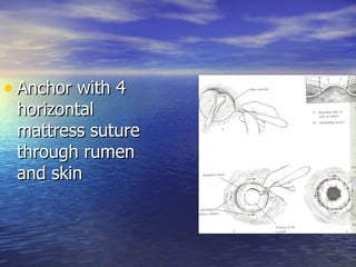 • Anchor with 4
 horizontal
 mattress suture
 through rumen
 and skin
 