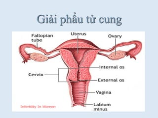 Giải phẩu tử cung
 