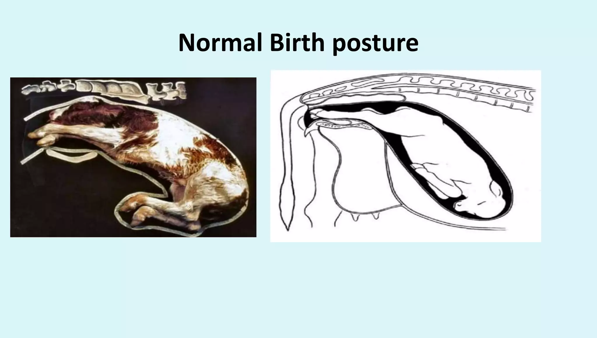 Normal Birth posture
 
