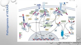 Vexa's Rashes VEXAS syndromes , a diagnostic Puzzlepptx | PPTX
