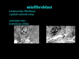 miofibroblast
karakteristike fibroblasta
i glatkih mišićnih ćelija
zarastanje rana –
kontrakcija ožiljka
 