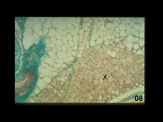 Histologija vezivnog tkiva. 