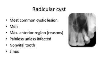 Radicular cyst
• Most common cystic lesion
• Men
• Max. anterior region (reasons)
• Painless unless infected
• Nonvital tooth
• Sinus
 