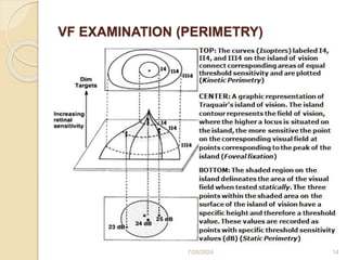 Visual field print out interpretation and analysis | PPTX