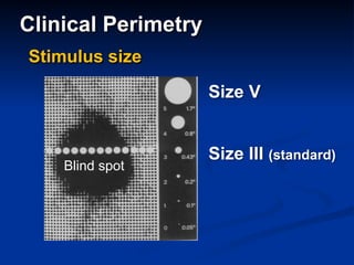 Clinical Perimetry
Stimulus size
Size V
Size III (standard)
Blind spot
 