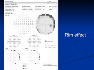 Rim effect
 