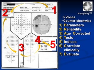 3
4 5
12 HumphreyTM
• 5 Zones
• Counter-clockwise
1) Parameters
2) Reliability
3) Age Corrected
4) Tests
5) Indices
6) Correlate
clinically
7) Evaluate
 