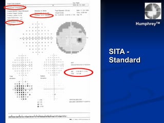 HumphreyTM
SITA -
Standard
 