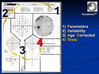 3
4
12 HumphreyTM
1) Parameters
2) Reliability
3) Age Corrected
4) Tests
 